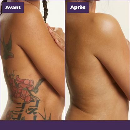 DermaShift™ – Perfecteur de couvrance corporelle