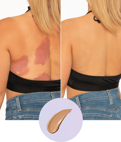 DermaShift™ – Body Coverage Perfector