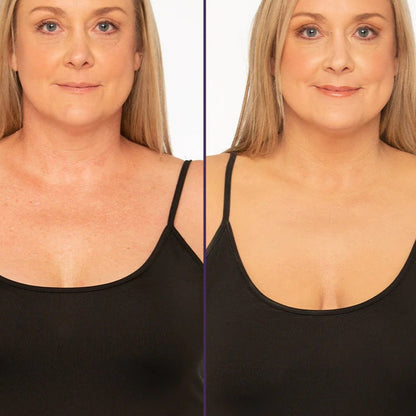 DermaShift™ – Body Coverage Perfector